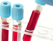 Ontwikkelingen in diagnostiek en behandeling van hemofilie